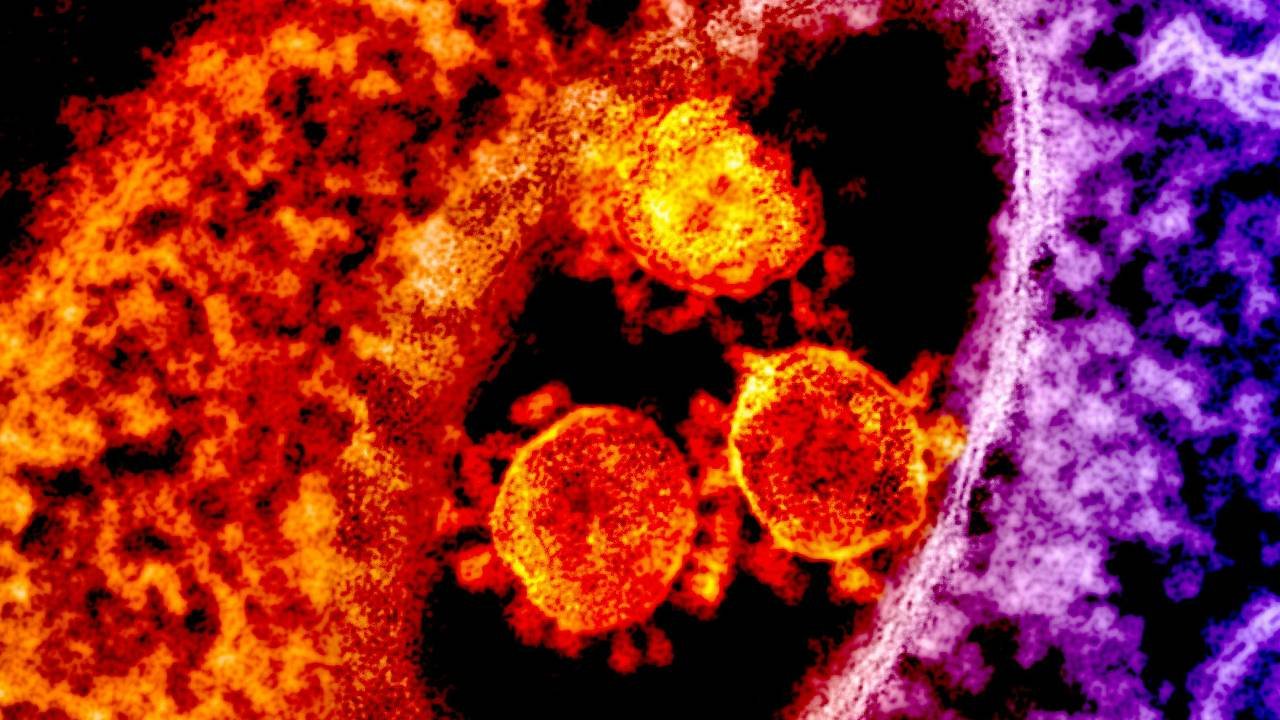 NIH/NIAID Fund Gain-of-Function COVID Mutant With 679-Fold Antibody Resistance