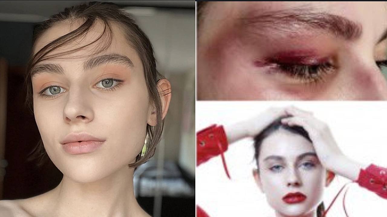 Polish Model Beaten And Nearly Gang Raped In Milan Before Being Rescued by Italian Man